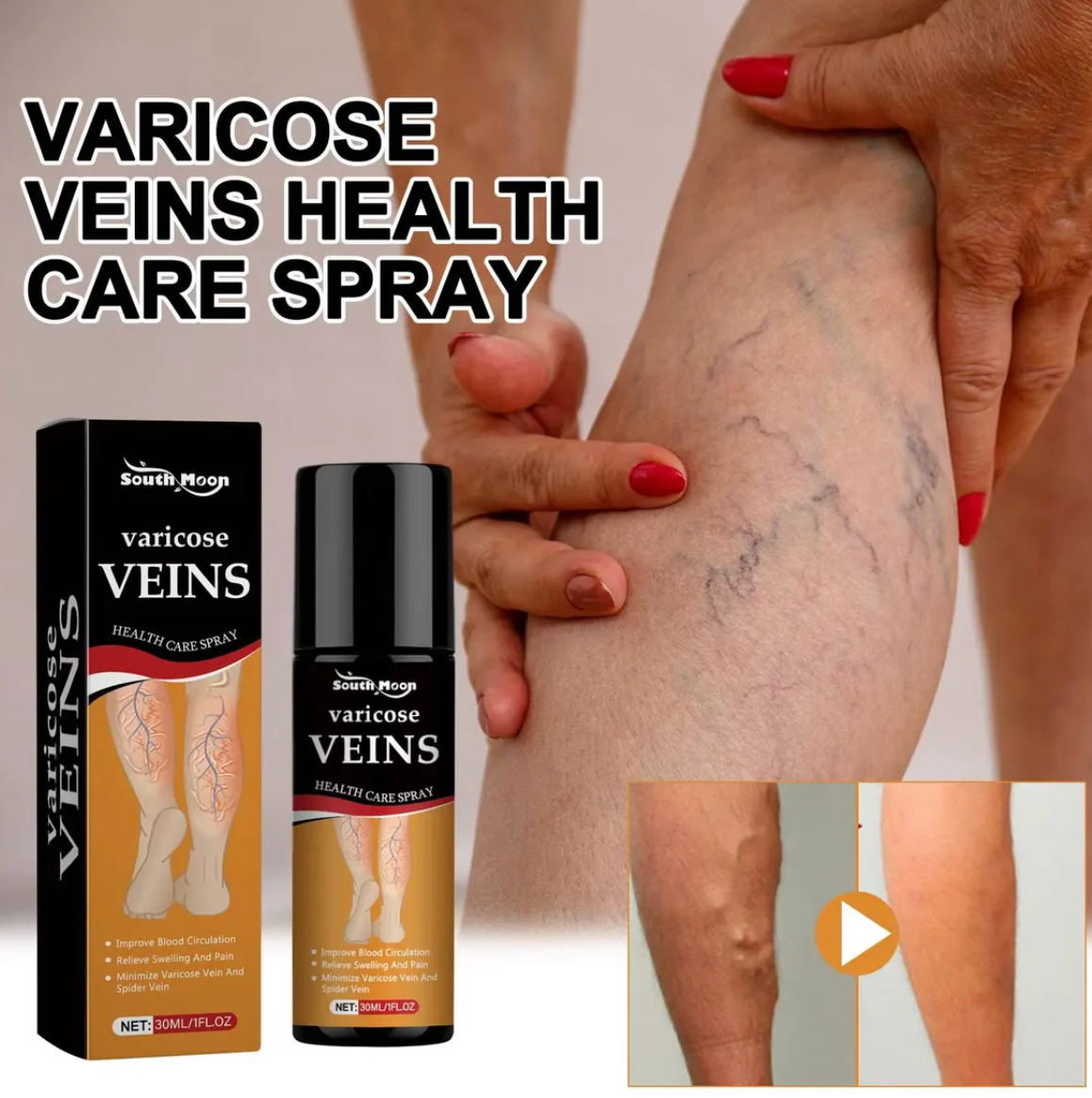 Varicose Veins Spray - Natural Herbal Formula for Fast Relief ( Pack Of 1 )